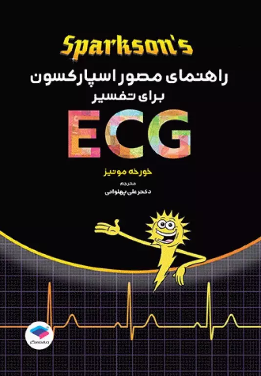 راهنمای مصور اسپارکسون برای تفسیر ECG